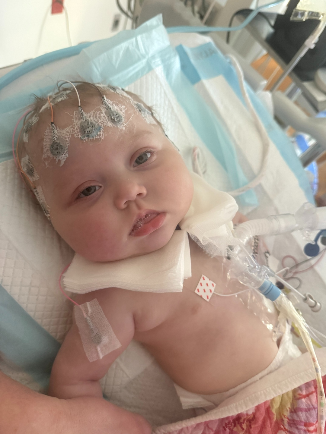 Iris during an EEG study, looking directly at camera