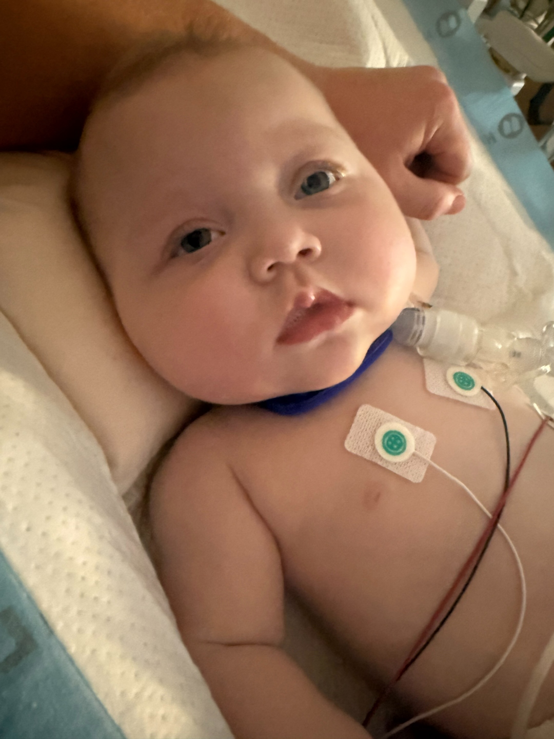 Iris in the hospital